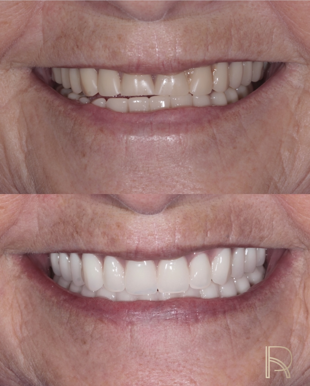 Reabilitação e estética do sorriso